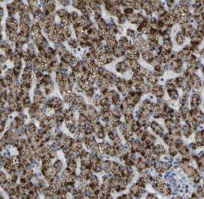 Immunohistochemistry-Paraffin: ACBD5 Antibody [NBP1-85146] - Staining of human liver shows strong granular cytoplasmic positivity in hepatocytes.