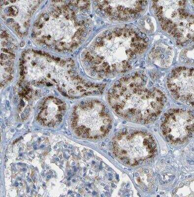 Immunohistochemistry-Paraffin: ACBD5 Antibody [NBP1-85146] - Staining of human kidney shows moderate granular cytoplasmic positivity in cells in tubules.