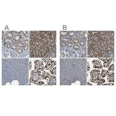 <b>Independent Antibodies Validation. </b>Immunohistochemistry-Paraffin: ACBD5 Antibody [NBP1-85146] - Staining of human kidney, liver, pancreas and small intestine using Anti-ACBD5 antibody NBP1-85146 (A) shows similar protein distribution across tissues to independent antibody NBP1-85145 (B).