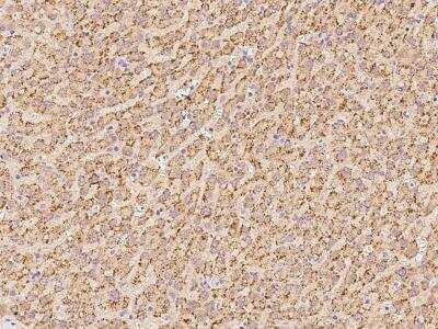Immunohistochemistry-Paraffin: ACBD5 Antibody [NBP2-97727] - Immunochemical staining of human ACBD5 in human liver with rabbit polyclonal antibody at 1:100 dilution, formalin-fixed paraffin embedded sections.