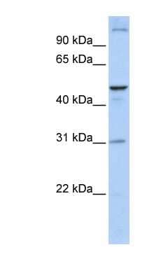 Western Blot: ACBD5 Antibody [NBP1-59820] - Human Brain lysate, concentration 0.2-1 ug/ml.