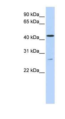 Western Blot ACBD5 Antibody - BSA Free
