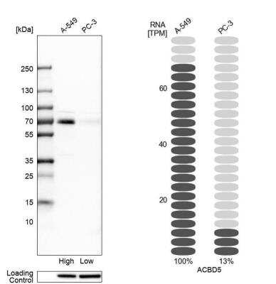 Western Blot: ACBD5 Antibody [NBP1-85145] - Analysis in human cell lines A-549 and PC-3. Corresponding RNA-seq data are presented for the same cell lines. Loading control: Anti-HSP90B1.