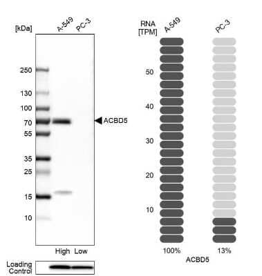 Western Blot ACBD5 Antibody - BSA Free