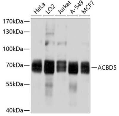 Western Blot: ACBD5 Antibody [NBP2-92034] - Analysis of extracts of various cell lines, using ACBD5 at 1:1000 dilution.Secondary antibody: HRP Goat Anti-Rabbit IgG (H+L) at 1:10000 dilution.Lysates/proteins: 25ug per lane.Blocking buffer: 3% nonfat dry milk in TBST.Detection: ECL Basic Kit .Exposure time: 1s.