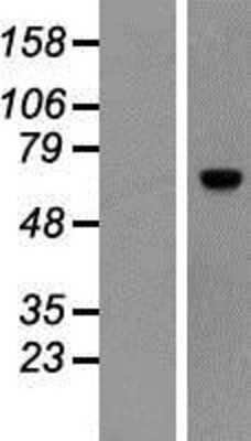 Western Blot ACBD5 Overexpression Lysate