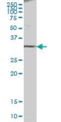 Western Blot: ACBD6 Antibody [H00084320-B01P] - Analysis of ACBD6 expression in human spleen.