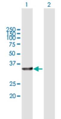 Western Blot: ACBD6 Antibody [H00084320-B01P] - Analysis of ACBD6 expression in transfected 293T cell line by ACBD6 polyclonal antibody.  Lane 1: ACBD6 transfected lysate(31.02 KDa). Lane 2: Non-transfected lysate.