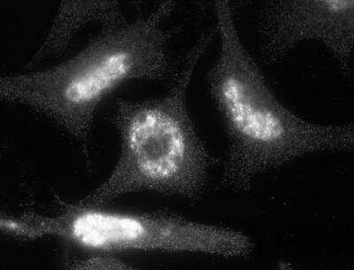 Immunocytochemistry/Immunofluorescence: ACBD7 Antibody [NBP1-56527] - Analysis of ACBD7 in 3T3-L1 cells using ACBD7 antibody. Image from verified customer review.