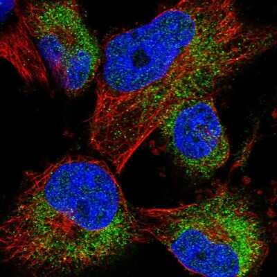 Immunocytochemistry/ Immunofluorescence ACBD7 Antibody - BSA Free