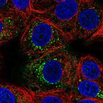 Immunocytochemistry/ Immunofluorescence ACBD7 Antibody - BSA Free