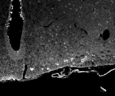 Immunocytochemistry/Immunofluorescence: ACBD7 Antibody [NBP1-56527] - Mouse arcuate nucleus stained with ACBD7 antibody. Image from verified customer review.