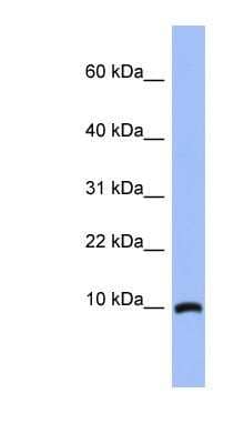 Western Blot ACBD7 Antibody - BSA Free