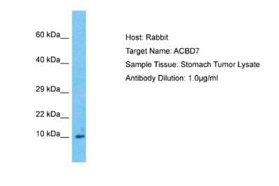 Western Blot: ACBD7 Antibody [NBP2-86945] - Host: Rabbit. Target Name: ACBD7. Sample Type: Stomach Tumor lysates. Antibody Dilution: 1.0ug/ml