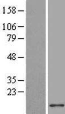 Western Blot: ACBD7 Overexpression Lysate (Adult Normal) [NBL1-07229] Left-Empty vector transfected control cell lysate (HEK293 cell lysate); Right -Over-expression Lysate for ACBD7.
