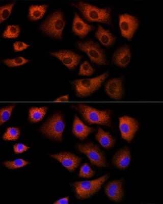 Immunocytochemistry/Immunofluorescence: ACBP Antibody [NBP2-92856] - Immunofluorescence analysis of NIH/3T3 cells using ACBP Rabbit pAb (NBP2-92856) at dilution of 1:100 (40x lens). Blue: DAPI for nuclear staining.