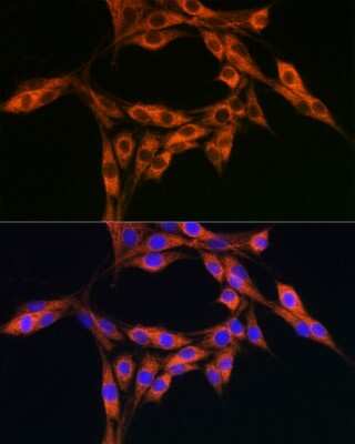 Immunocytochemistry/Immunofluorescence: ACBP Antibody [NBP2-92856] - Immunofluorescence analysis of PC-12 cells using ACBP Rabbit pAb (NBP2-92856) at dilution of 1:100 (40x lens). Blue: DAPI for nuclear staining.