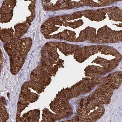 Immunohistochemistry-Paraffin: ACBP Antibody [NBP2-38648] - Staining of human prostate shows strong cytoplasmic positivity in glandular cells.