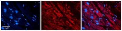 Immunohistochemistry-Paraffin: ACBP Antibody [NBP2-86946] - Rabbit Anti-DBI Antibody. Formalin Fixed Paraffin Embedded Tissue: Human heart Tissue. Observed Staining: Cytoplasmic. Primary Antibody Concentration: 1:100. Other Working Concentrations: 1:600.