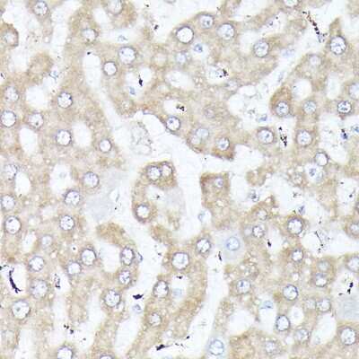 Immunohistochemistry-Paraffin: ACBP Antibody [NBP2-92856] - Immunohistochemistry of paraffin-embedded rat liver using ACBP Rabbit pAb (NBP2-92856) at dilution of 1:250 (40x lens). Perform high pressure antigen retrieval with 10 mM citrate buffer pH 6.0 before commencing with IHC staining protocol.