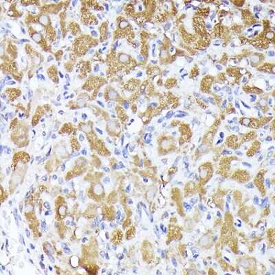 Immunohistochemistry-Paraffin: ACBP Antibody [NBP2-92856] - Immunohistochemistry of paraffin-embedded rat ovary using ACBP Rabbit pAb (NBP2-92856) at dilution of 1:250 (40x lens). Perform high pressure antigen retrieval with 10 mM citrate buffer pH 6.0 before commencing with IHC staining protocol.