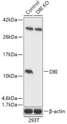 Knockout Validated: ACBP Antibody [NBP3-03241] - Analysis of extracts from normal (control) and DBI knockout (KO) 293T cells, using ACBP antibody at 1:1000 dilution. Secondary antibody: HRP Goat Anti-Rabbit IgG (H+L) at 1:10000 dilution. Lysates/proteins: 25ug per lane. Blocking buffer:% nonfat dry milk in TBST.