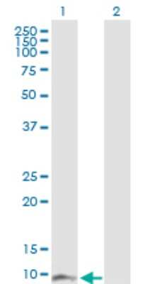Western Blot: ACBP Antibody [H00001622-D01P] - Analysis of DBI expression in transfected 293T cell line by DBI polyclonal antibody.Lane 1: DBI transfected lysate(11.80 KDa).Lane 2: Non-transfected lysate.