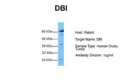 Western Blot: ACBP Antibody [NBP1-54806] - Sample Tissue: Human Ovary Tumor Antibody Dilution: 1.0 ug/ml