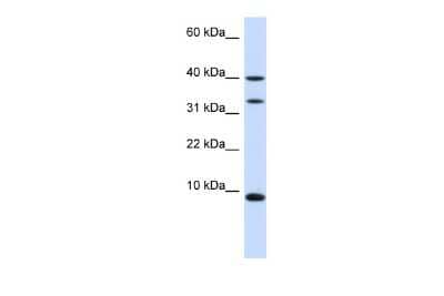 Western Blot: ACBP Antibody [NBP1-54806] - Reccomended Titration: 0.2 - 1 ug/ml ELISA Titer: 1:1562500 Positive Control: Human Liver