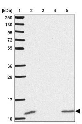 Western Blot: ACBP Antibody [NBP2-38648] - Lane 1: Marker  [kDa] 250, 130, 95, 72, 55, 36, 28, 17, 10.  Lane 2: Human cell line RT-4.  Lane 3: Human cell line U-251MG.  Lane 4: Human Plasma.  Lane 5: Human liver tissue