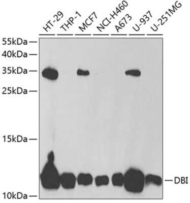 Western Blot: ACBP Antibody [NBP2-92457] - Analysis of extracts of various cell lines, using ACBP at 1:1000 dilution.Secondary antibody: HRP Goat Anti-Rabbit IgG (H+L) at 1:10000 dilution.Lysates/proteins: 25ug per lane.Blocking buffer: 3% nonfat dry milk in TBST.Detection: ECL Basic Kit .Exposure time: 90s.