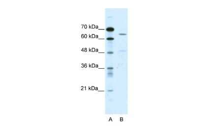 Western Blot: ACCN1 Antibody [NBP2-84380] - WB Suggested Anti-ACCN1 Antibody Titration: 0.2-1 ug/ml. ELISA Titer: 1:312500. Positive Control: HepG2 cell lysate