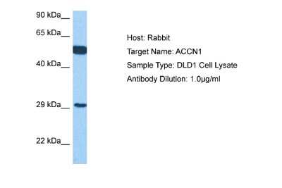 Western Blot: ACCN1 Antibody [NBP2-84382] - Host: Rabbit. Target Name: ACCN1. Sample Tissue: Human DLD1 Whole Cell lysates. Antibody Dilution: 1ug/ml