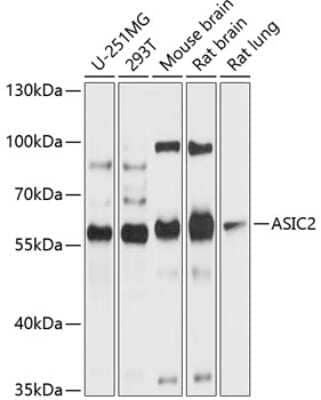 Western Blot ACCN1 Antibody - BSA Free