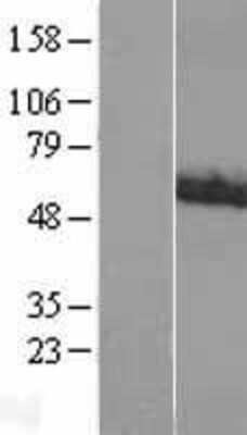 Western Blot: ACCN1 Overexpression Lysate (Adult Normal) [NBL1-07230] Left-Empty vector transfected control cell lysate (HEK293 cell lysate); Right -Over-expression Lysate for ACCN1.