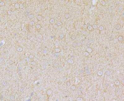 Immunohistochemistry: ACCN2 Antibody [NBP2-76909] - Immunohistochemical analysis of paraffin-embedded rat brain tissue using anti-ACCN2 antibody. Counter stained with hematoxylin.