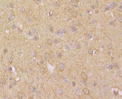 Immunohistochemistry: ACCN2 Antibody [NBP2-76909] - Immunohistochemical analysis of paraffin-embedded mouse brain tissue using anti-ACCN2 antibody. Counter stained with hematoxylin.