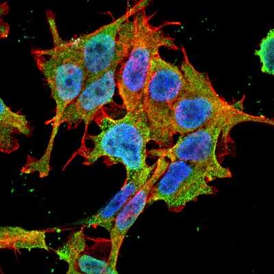 Immunocytochemistry/Immunofluorescence: ACCN2 Antibody (S271-44) [NBP2-22409] - Tissue: Neuroblastoma cell line SK-N-BE. Species: Human. Fixation: 4% Formaldehyde for 15 min at RT. Primary Antibody: Mouse Anti-ASIC1 Monoclonal Antibody at 1:100 for 60 min at RT. Secondary Antibody: Goat Anti-Mouse ATTO 488 at 1:100 for 60 min at RT. Counterstain: Phalloidin Texas Red F-Actin stain; DAPI (blue) nuclear stain at 1:1000, 1:5000 for 60min RT, 5min RT. Localization: Cell Membrane, Nucleus. Magnification: 60X.