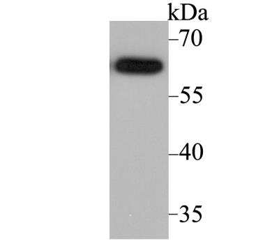 Western Blot: ACCN2 Antibody [NBP2-76909] - Western blot analysis of ACCN2 on SH-SY-5Y cell lysate using anti-ACCN2 antibody at 1/2,000 dilution.