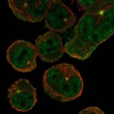 Immunocytochemistry/ Immunofluorescence ACCN4 Antibody - BSA Free