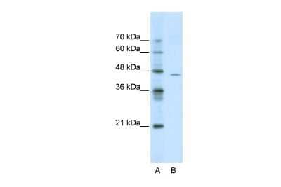 Western Blot: ACCN4 Antibody [NBP2-83921] - WB Suggested Anti-ACCN4 Antibody Titration: 0.2-1 ug/ml. ELISA Titer: 1:500. Positive Control: Jurkat cell lysate