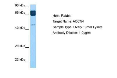 Western Blot: ACCN4 Antibody [NBP2-83922] - Host: Rabbit. Target Name: ACCN4. Sample Tissue: Ovary Tumor lysates. Antibody Dilution: 1ug/ml