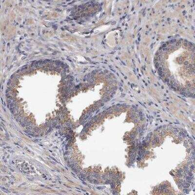 Immunohistochemistry: ACCN5 Antibody [NBP1-86356] - Staining of human prostate shows moderate cytoplasmic positivity in glandular cells.