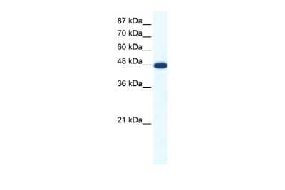 Western Blot: ACCN5 Antibody [NBP2-84384] - WB Suggested Anti-ACCN5 Antibody Titration: 1.25ug/ml. ELISA Titer: 1:312500. Positive Control: Jurkat cell lysate