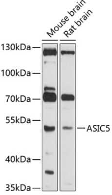 Western Blot ACCN5 Antibody - BSA Free