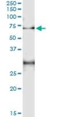 Immunoprecipitation: ACD Antibody (1C11-1A7) [H00065057-M01] - Analysis of ACD transfected lysate using anti-ACD monoclonal antibody and Protein A Magnetic Bead, and immunoblotted with ACD MaxPab rabbit polyclonal antibody.