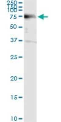 Immunoprecipitation: ACD Antibody (1D8-1B6) [H00065057-M02] - Analysis of ACD transfected lysate using anti-ACD monoclonal antibody and Protein A Magnetic Bead, and immunoblotted with ACD MaxPab rabbit polyclonal antibody.