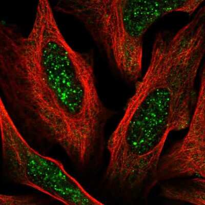 Immunocytochemistry/Immunofluorescence: ACD Antibody [NBP2-33839] - Immunofluorescent staining of human cell line U-2 OS shows localization to nuclear bodies.