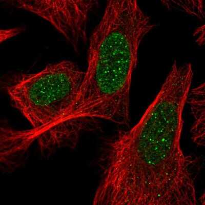 Immunocytochemistry/Immunofluorescence: ACD Antibody [NBP2-58187] - Staining of human cell line U-2 OS shows localization to nuclear bodies.