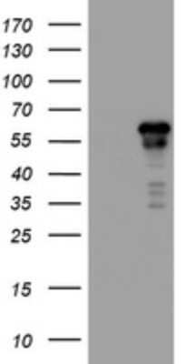 Western Blot: ACD Antibody (OTI2B1) - Azide and BSA Free [NBP2-72169] - Analysis of HEK293T cells were transfected with the pCMV6-ENTRY control (Left lane) or pCMV6-ENTRY ACD.